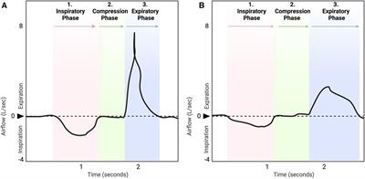 Hypotussic cough in persons with dysphagia: biobehavioral interventions and pathways to clinical implementation